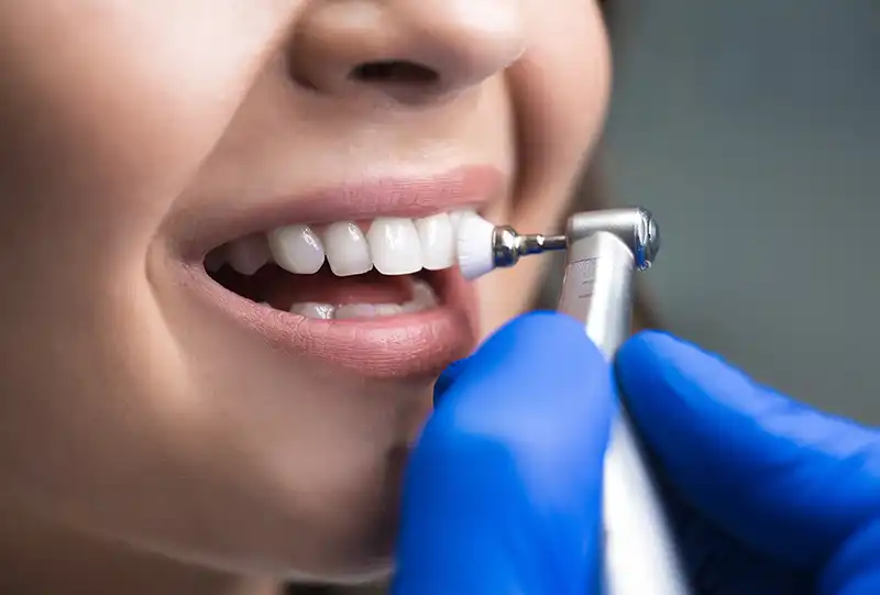 Patient receiving a routine professional teeth cleaning at Village Dental North Raleigh, NC