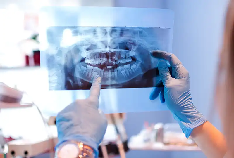 Digital dental X-ray and intraoral camera being used during a general dentistry exam at Village Dental North Raleigh, NC