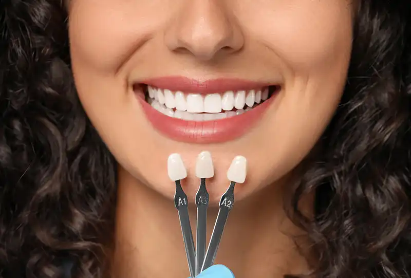 Digital smile design preview on screen during a veneers consult at Village Dental in Raleigh, NC