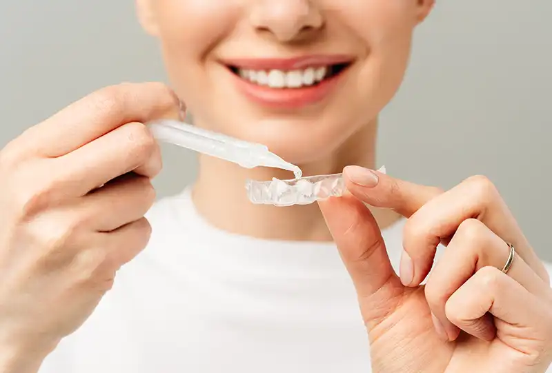 Custom whitening trays and professional whitening gel ready for a patient at Village Dental Olde Raleigh in Raleigh, NC