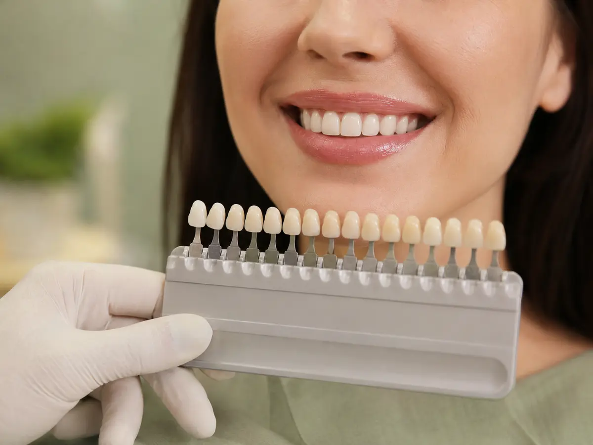 Veneers at Village Dental